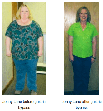 Jennifer's Story