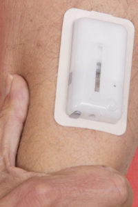 diabeties_cvmc-t_cu-01-web